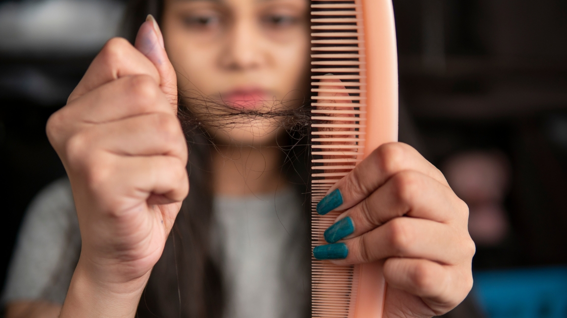 Hair fall treatment image
